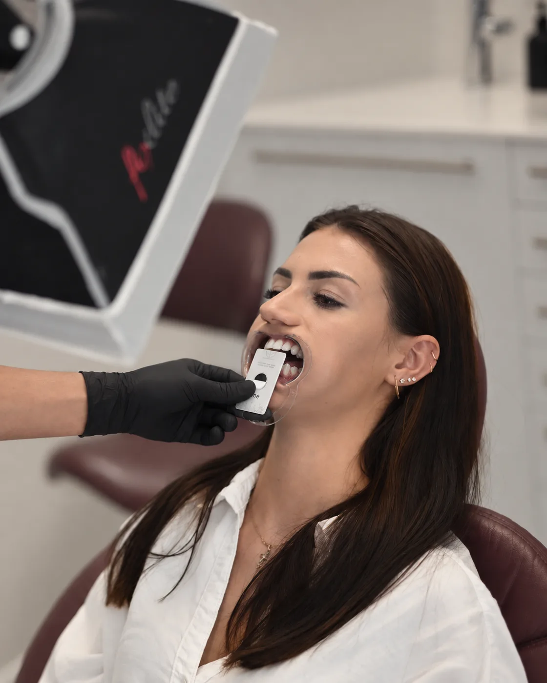 A clinical photograph being taken with a shade tab during the aesthetic assessment.